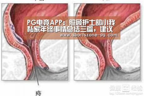 PG入口